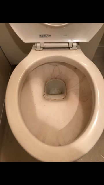 渋谷広尾店 さぼったリングどころじゃない トイレの黒ずみと黄ばみを簡単除去する プロの技 ハウスクリーニングのことならおそうじ革命