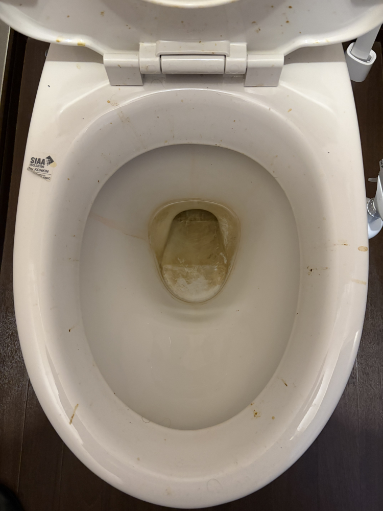 東京都小平市学園東町のトイレクリーニングの作業前1