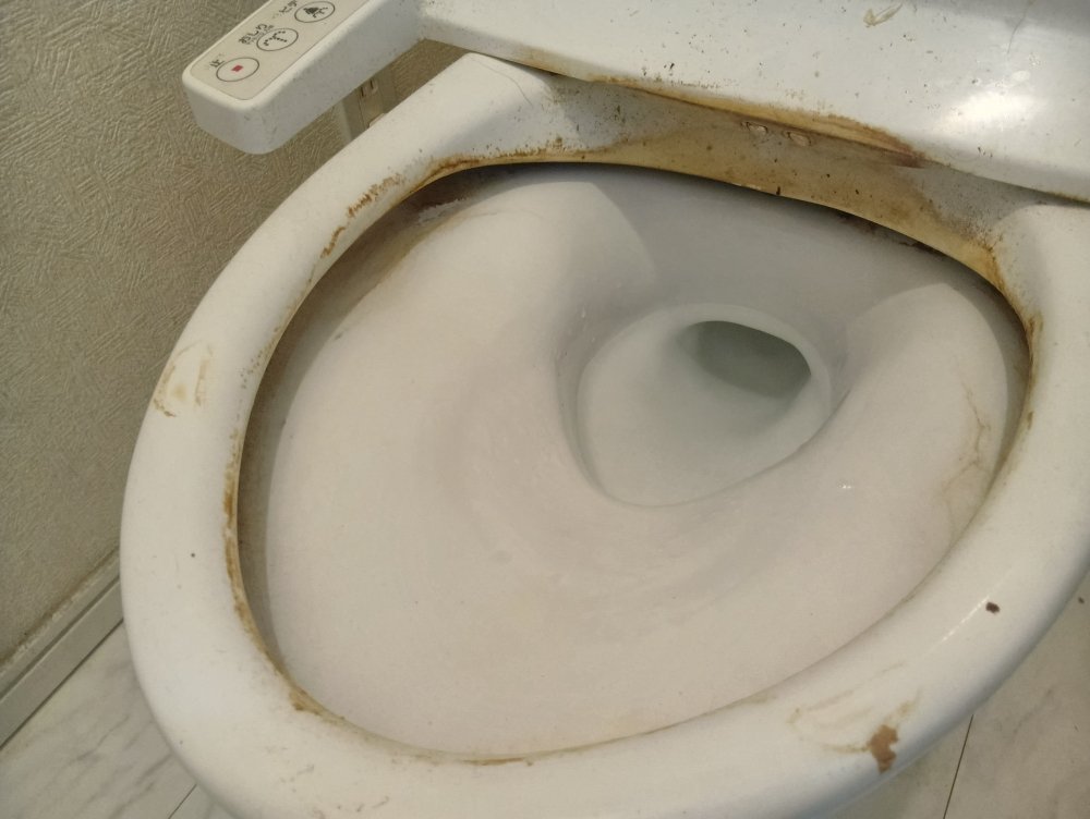 東京都文京区目白台のトイレクリーニングの作業前1
